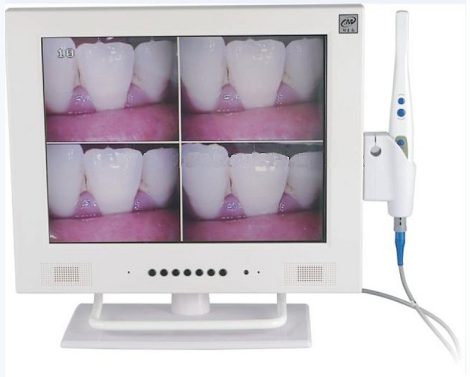 Monitor 15" LCD M 958A +Oral kamera; Video, USB, HDMI, WiFi kapcsolat